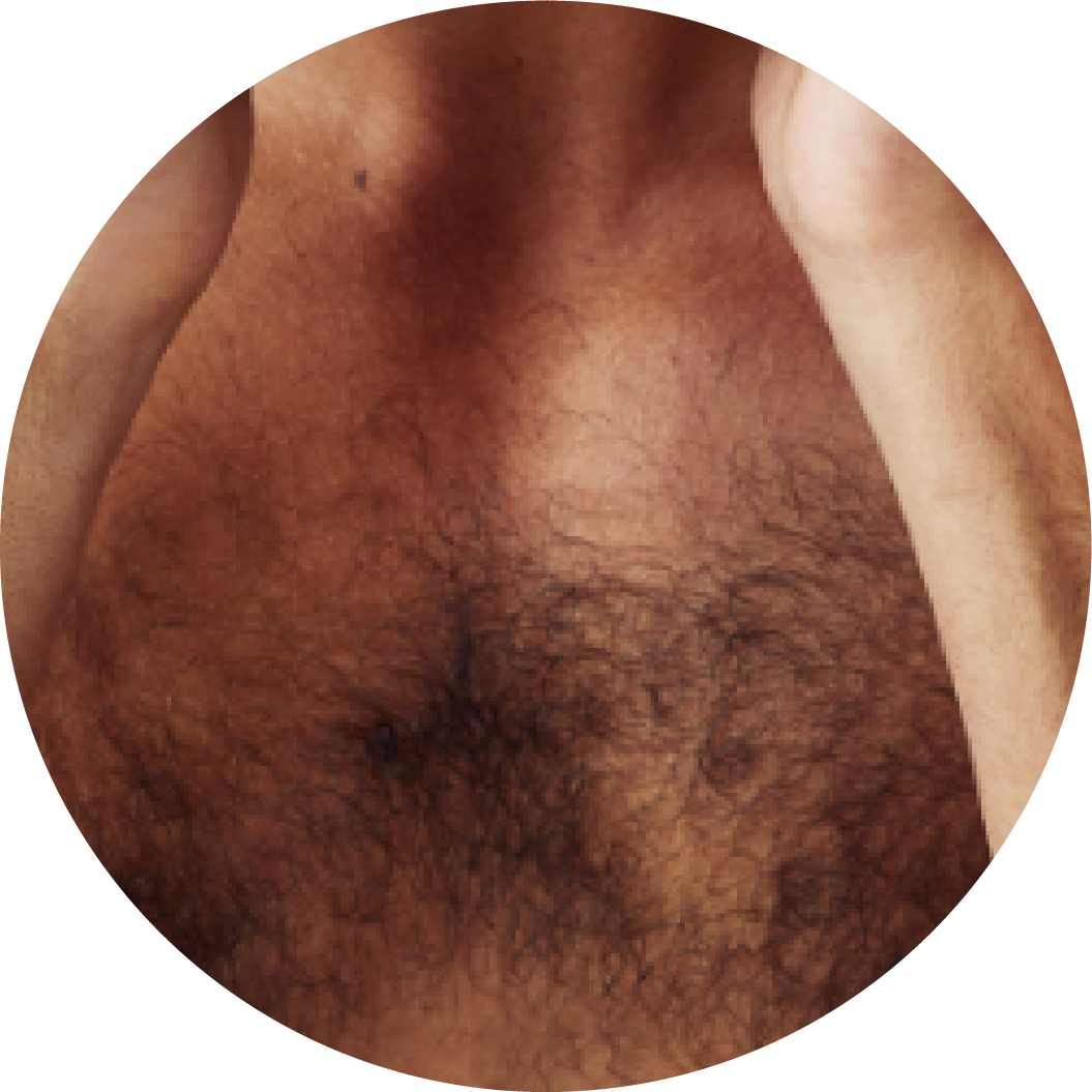 Brazilian wax prep in Berkeley